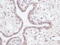 Insulin Like Growth Factor Binding Protein 3 antibody, 38-250, ProSci, Immunohistochemistry frozen image 