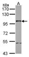 Nucleoporin 98 antibody, NBP2-19612, Novus Biologicals, Western Blot image 