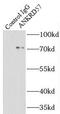 Sosondowah Ankyrin Repeat Domain Family Member C antibody, FNab00419, FineTest, Immunoprecipitation image 