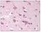 SPARC Related Modular Calcium Binding 2 antibody, AP08321PU-N, Origene, Immunohistochemistry paraffin image 