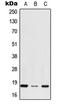 Ribosomal Protein S27 antibody, LS-C353769, Lifespan Biosciences, Western Blot image 