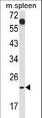 CD7 Molecule antibody, LS-C168557, Lifespan Biosciences, Western Blot image 