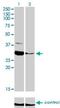 Zinc Finger Protein 215 antibody, H00007762-M01, Novus Biologicals, Western Blot image 