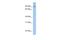 Negative Regulator Of Reactive Oxygen Species antibody, A13116, Boster Biological Technology, Western Blot image 