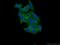 Carbonic Anhydrase 3 antibody, 15197-1-AP, Proteintech Group, Immunofluorescence image 