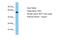 Retinoic Acid Induced 2 antibody, A15118, Boster Biological Technology, Western Blot image 