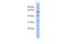 Pre-MRNA Processing Factor 4 antibody, A08225-1, Boster Biological Technology, Western Blot image 