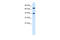 TOX High Mobility Group Box Family Member 2 antibody, 27-264, ProSci, Western Blot image 