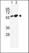 Gamma-Aminobutyric Acid Type A Receptor Alpha2 Subunit antibody, PA5-26305, Invitrogen Antibodies, Western Blot image 