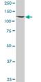 CWC22 Spliceosome Associated Protein Homolog antibody, H00057703-B01P, Novus Biologicals, Western Blot image 