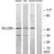 Protein Kinase C Substrate 80K-H antibody, A04992, Boster Biological Technology, Western Blot image 