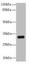 Transmembrane Protein 192 antibody, A61394-100, Epigentek, Western Blot image 