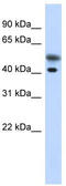 Tropomodulin 2 antibody, TA334551, Origene, Western Blot image 