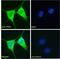 PTCH1 antibody, NB100-2451, Novus Biologicals, Immunocytochemistry image 