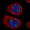 Treacle Ribosome Biogenesis Factor 1 antibody, HPA038238, Atlas Antibodies, Immunofluorescence image 