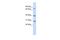 E3 ubiquitin-protein ligase RNF6 antibody, PA5-42287, Invitrogen Antibodies, Western Blot image 