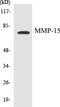 Matrix Metallopeptidase 15 antibody, EKC1377, Boster Biological Technology, Western Blot image 