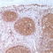 CD79a antibody, TA327654, Origene, Immunohistochemistry frozen image 