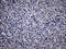 Thyroglobulin antibody, LS-C793866, Lifespan Biosciences, Immunohistochemistry paraffin image 