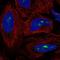 Zinc Finger Protein 286A antibody, HPA021594, Atlas Antibodies, Immunofluorescence image 