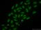 Acidic Nuclear Phosphoprotein 32 Family Member B antibody, 66160-1-Ig, Proteintech Group, Immunofluorescence image 