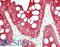 Keratin 18 antibody, LS-B14768, Lifespan Biosciences, Immunohistochemistry paraffin image 