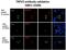 Transient Receptor Potential Cation Channel Subfamily V Member 2 antibody, NBP1-32096, Novus Biologicals, Immunocytochemistry image 