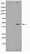 Cyclin Dependent Kinase 15 antibody, TA347634, Origene, Western Blot image 