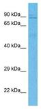 Kinesin Family Member 3B antibody, GTX35189, GeneTex, Western Blot image 