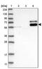 Dipeptidyl Peptidase 7 antibody, PA5-54369, Invitrogen Antibodies, Western Blot image 