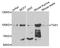 Trimethylguanosine Synthase 1 antibody, A7848, ABclonal Technology, Western Blot image 