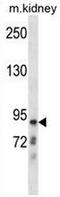 Chloride Voltage-Gated Channel Kb antibody, AP50941PU-N, Origene, Western Blot image 