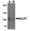 NLR Family Pyrin Domain Containing 7 antibody, NBP1-76290, Novus Biologicals, Western Blot image 