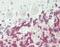 DNA-directed RNA polymerase II subunit RPB3 antibody, A09308-1, Boster Biological Technology, Immunohistochemistry paraffin image 