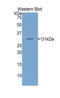 Electron Transfer Flavoprotein Subunit Alpha antibody, LS-C293737, Lifespan Biosciences, Western Blot image 