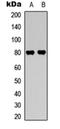 Protein Kinase C Beta antibody, orb315663, Biorbyt, Western Blot image 