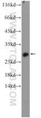 Homeobox B7 antibody, 12613-1-AP, Proteintech Group, Western Blot image 