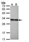 Phosphoglycerate Mutase 2 antibody, orb74172, Biorbyt, Western Blot image 