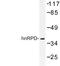 Heterogeneous Nuclear Ribonucleoprotein D antibody, LS-C176532, Lifespan Biosciences, Western Blot image 