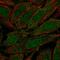 Zinc Finger Protein 510 antibody, HPA049139, Atlas Antibodies, Immunofluorescence image 