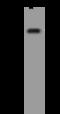 Potassium Two Pore Domain Channel Subfamily K Member 5 antibody, 205855-T32, Sino Biological, Western Blot image 