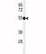 TNF Receptor Superfamily Member 8 antibody, F48920-0.4ML, NSJ Bioreagents, Western Blot image 