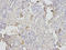 Triosephosphate Isomerase 1 antibody, A02559, Boster Biological Technology, Immunohistochemistry paraffin image 