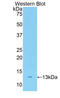 IBP-8 antibody, LS-C293509, Lifespan Biosciences, Western Blot image 