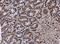 Hypoxanthine Phosphoribosyltransferase 1 antibody, NBP1-33527, Novus Biologicals, Immunohistochemistry paraffin image 