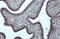 B-Raf Proto-Oncogene, Serine/Threonine Kinase antibody, GTX100913, GeneTex, Immunohistochemistry paraffin image 