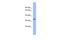 Ficolin 3 antibody, A04367, Boster Biological Technology, Western Blot image 