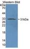 Natural Cytotoxicity Triggering Receptor 1 antibody, LS-C686356, Lifespan Biosciences, Western Blot image 