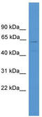 Major Facilitator Superfamily Domain Containing 13A antibody, TA338677, Origene, Western Blot image 