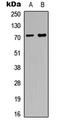 Mitogen-Activated Protein Kinase Kinase Kinase 1 antibody, LS-C358798, Lifespan Biosciences, Western Blot image 